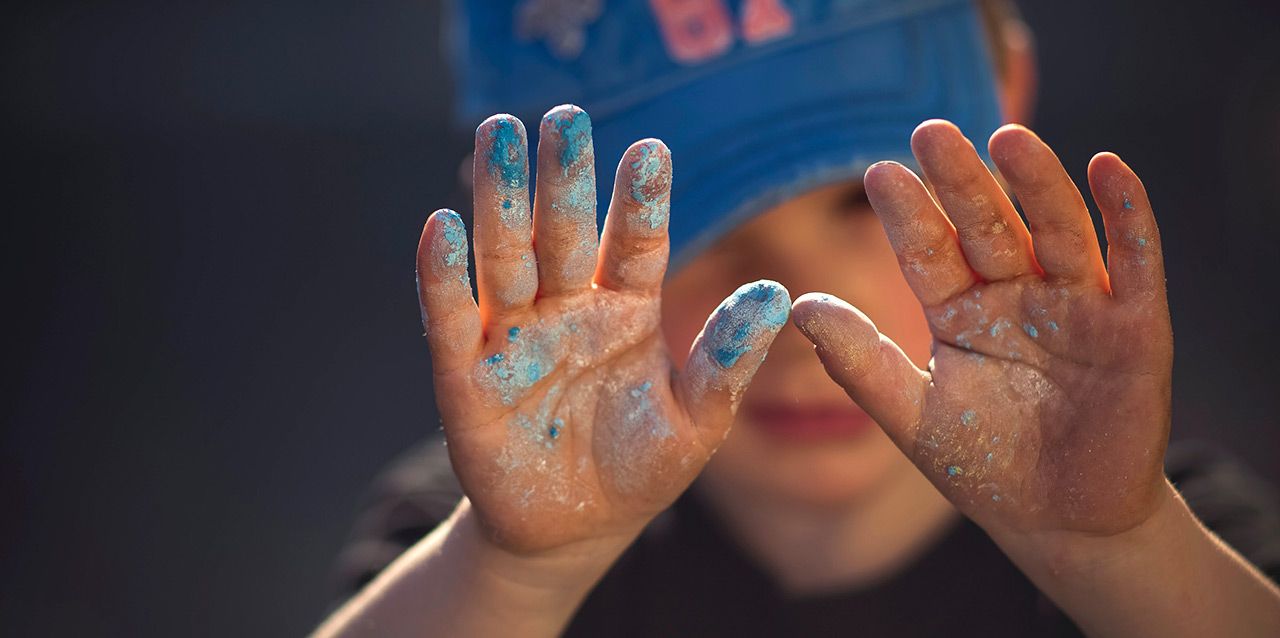 manos de niño con manchas azules